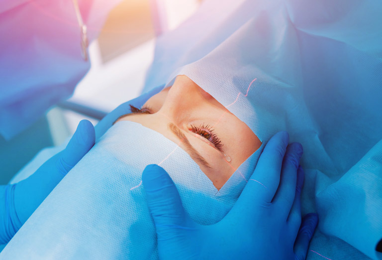 LASIK : la chirurgie laser