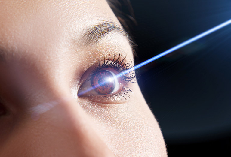 Le traitement au laser pour corriger les troubles de la vision