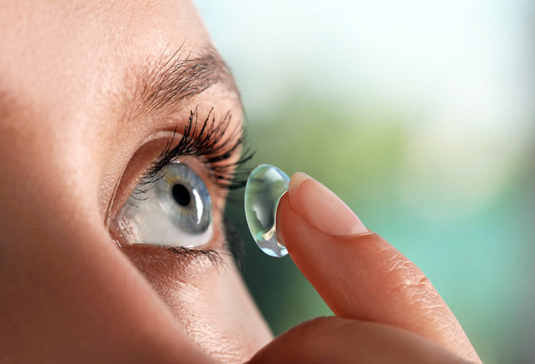 Lentilles journalières ou mensuelles : lesquelles choisir ?